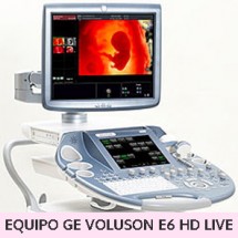 Máy siêu âm màu 4D chuyên sản cao cấp