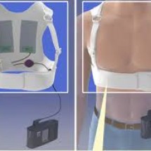Áo khử rung tim- Life Vest Zoll